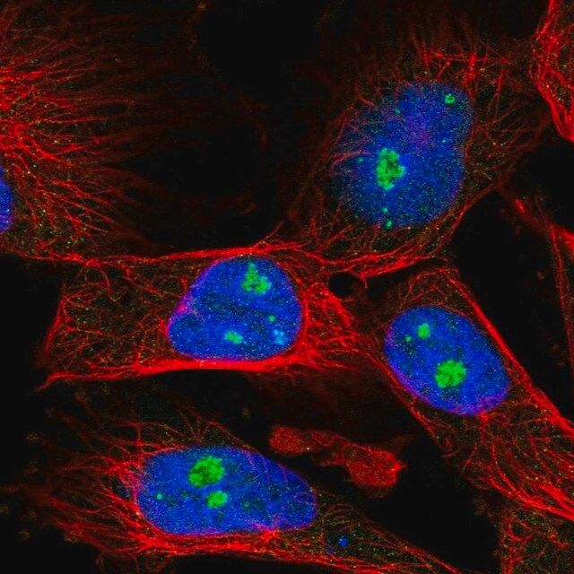 Anti-FBL antibody produced in rabbit