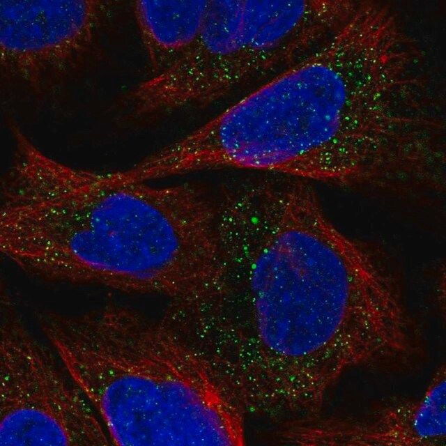 Anti-ESPN antibody produced in rabbit