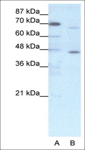 Anti-ESR2 antibody produced in rabbit