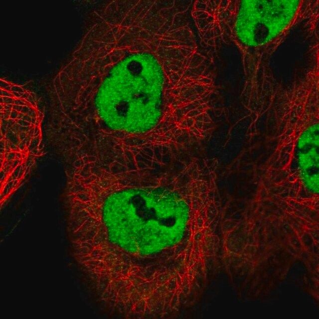 Anti-ESRP2 antibody produced in rabbit