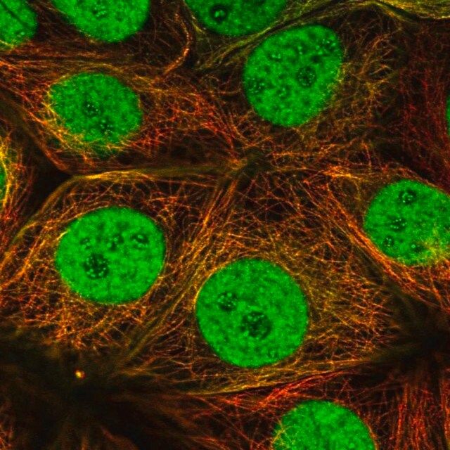 Anti-ESRRA antibody produced in rabbit