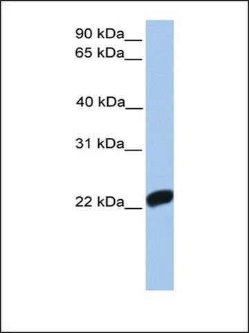 Anti-F10 antibody produced in rabbit