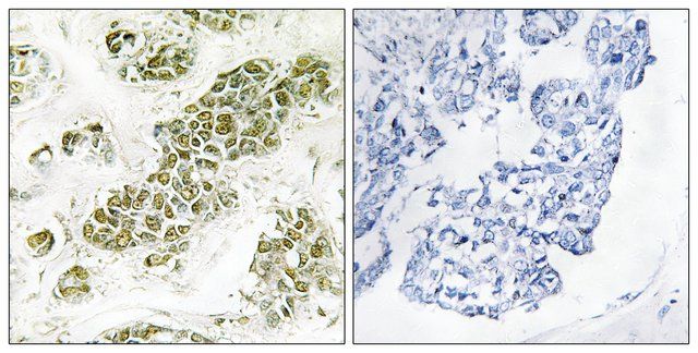 Anti-EIF2 α antibody produced in rabbit