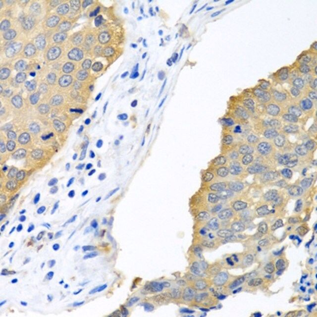 Anti-eIF4E antibody produced in rabbit