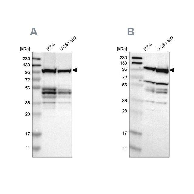 Anti-EIF4G2 antibody produced in rabbit