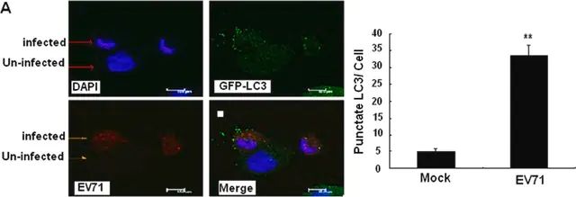 Anti-Enterovirus 71 Antibody, cross-reacts with Coxsackie A16, clone 422-8D-4C-4D