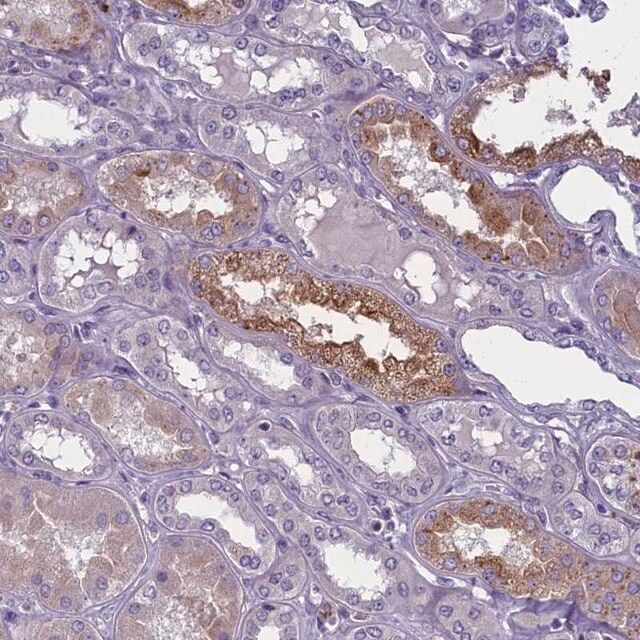 Anti-ENPP6 antibody produced in rabbit