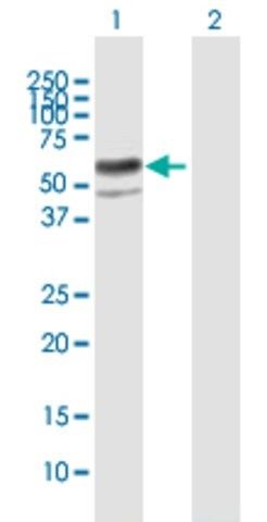Anti-ENTPD8 antibody produced in mouse