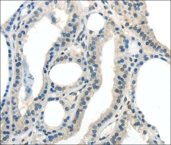 Anti-ENTPD1