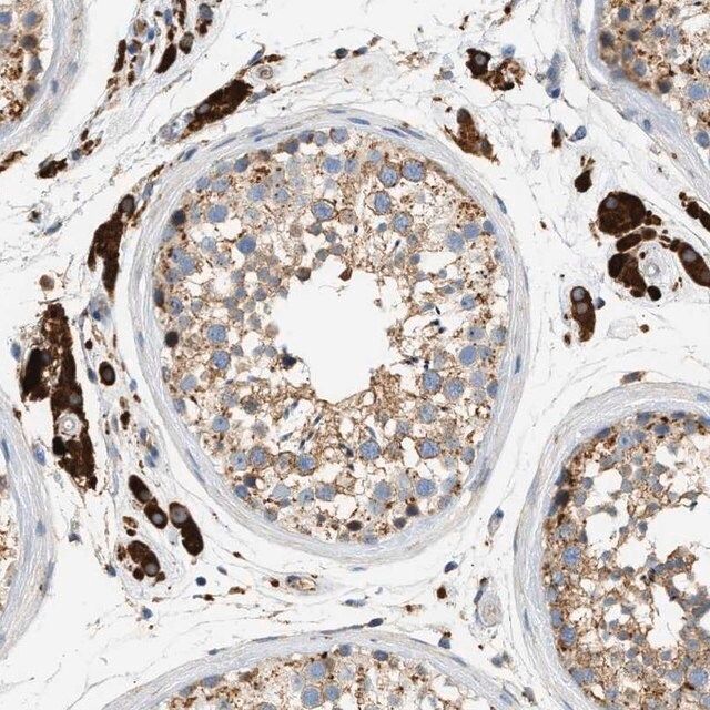 Anti-ENTHD1 antibody produced in rabbit