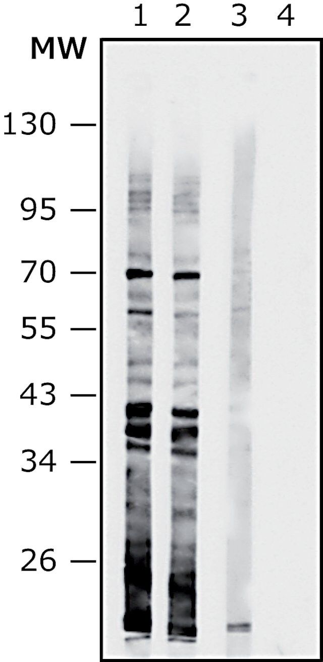 Anti-Enterococcus faecalis antibody produced in rabbit