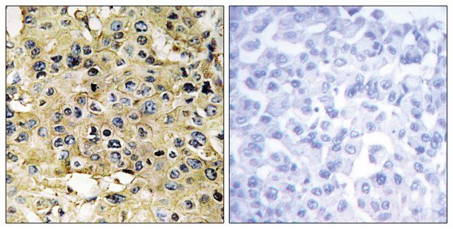 Anti-ENTK antibody produced in rabbit