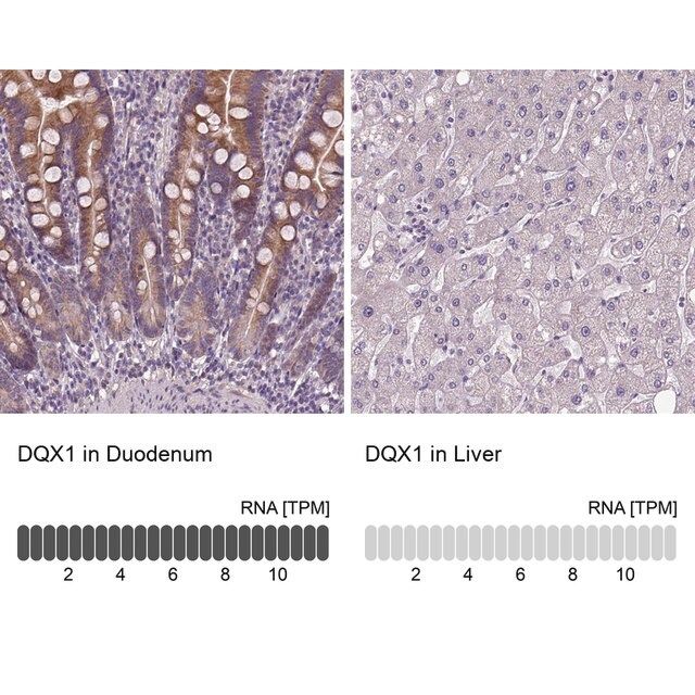 Anti-DQX1 antibody produced in rabbit