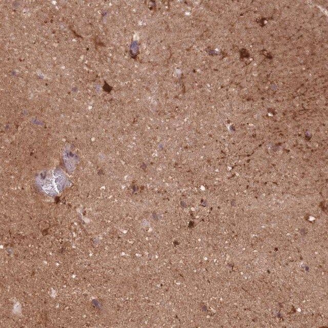 Anti-DPYSL4 antibody produced in rabbit