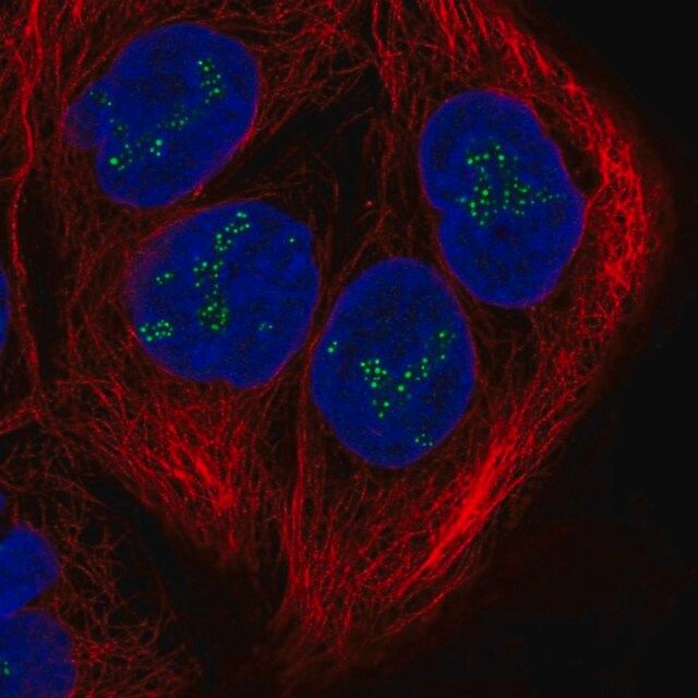 Anti-DZANK1 antibody produced in rabbit