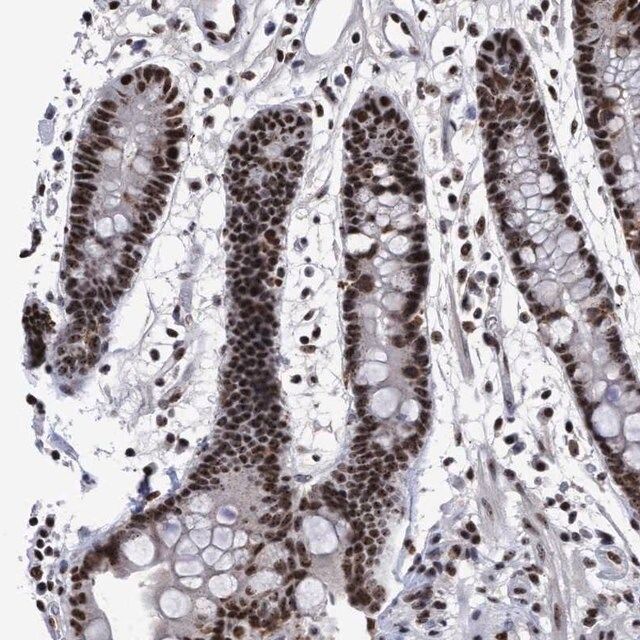 Anti-EFCAB10 antibody produced in rabbit