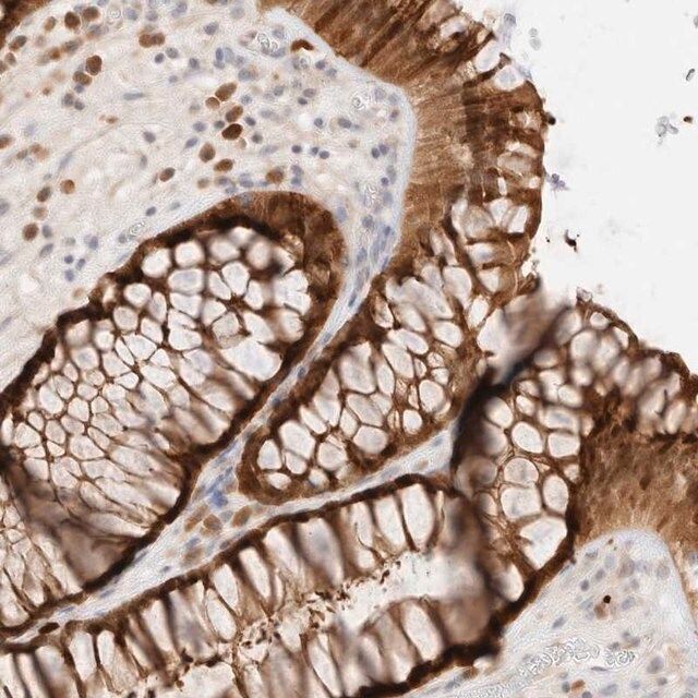 Anti-EFCAB13 antibody produced in rabbit