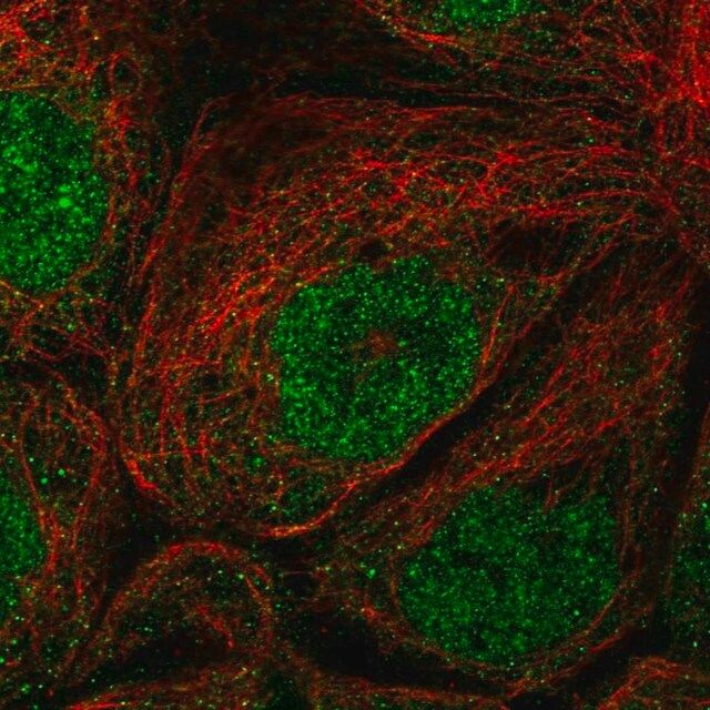Anti-EFCAB1 antibody produced in rabbit