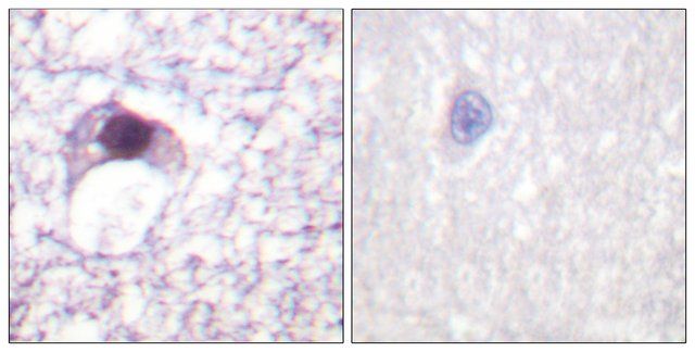 Anti-E2F6 antibody produced in rabbit