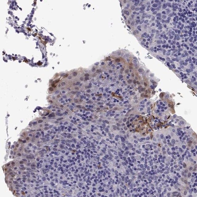 Anti-DOK5 antibody produced in rabbit
