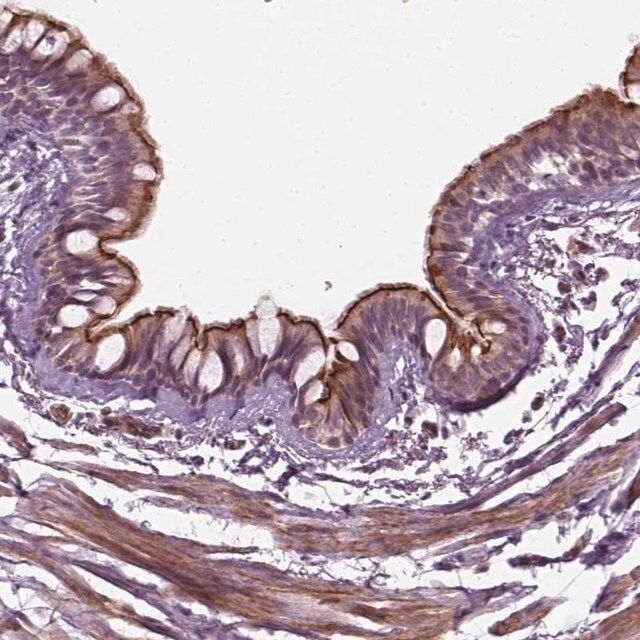 Anti-DNASE1L1 antibody produced in rabbit