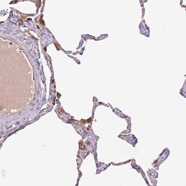 Anti-DOCK6 antibody produced in rabbit