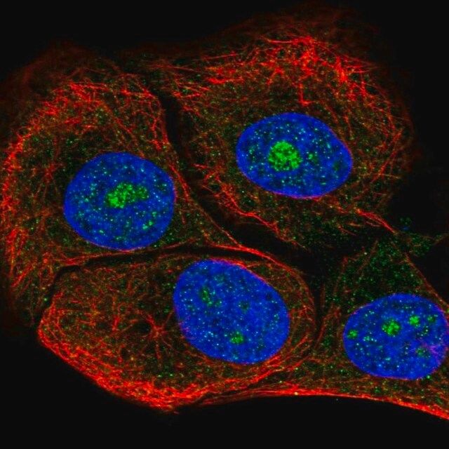 Anti-DOLK antibody produced in rabbit
