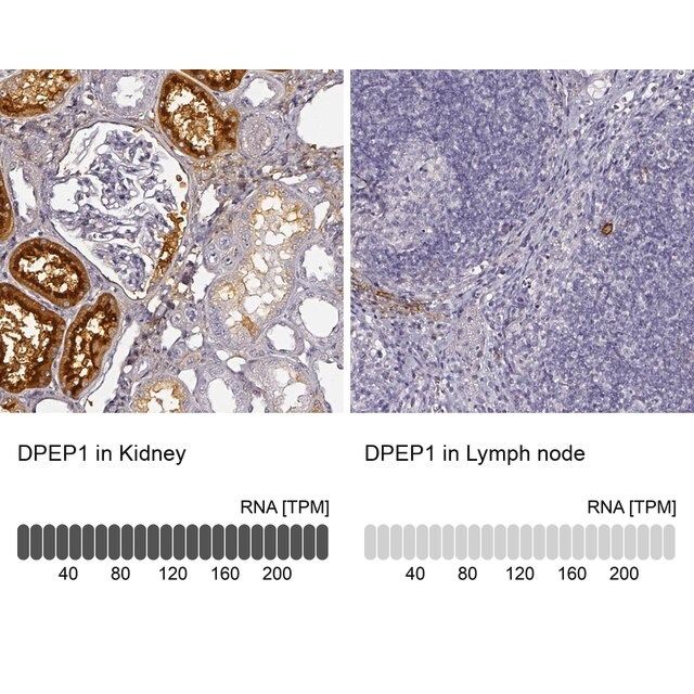 Anti-DPEP1 antibody produced in rabbit