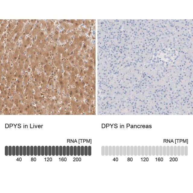 Anti-DPYS antibody produced in rabbit