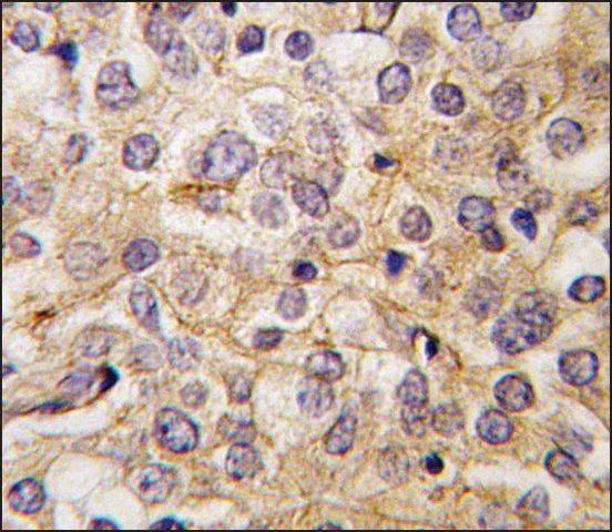 Anti-DPPA4 (N-term) antibody produced in rabbit
