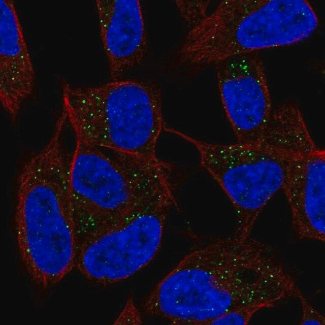 Anti-DPT antibody produced in rabbit