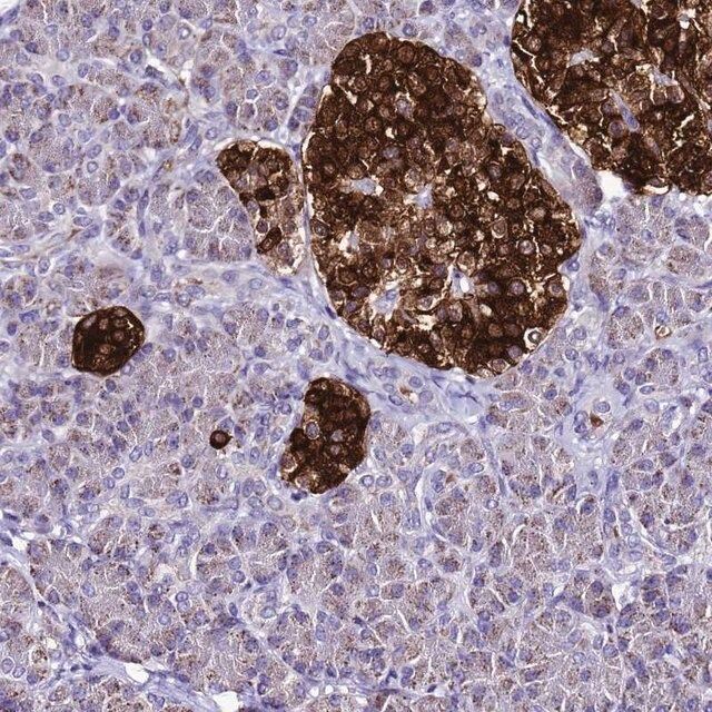 Anti-DPH6 antibody produced in rabbit