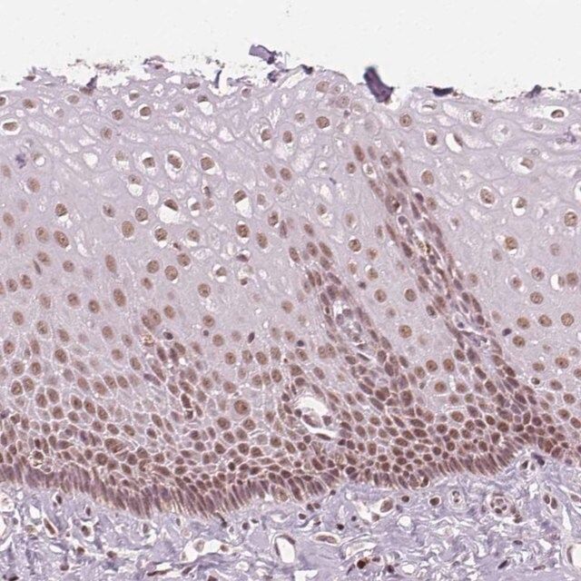 Anti-DPM2 antibody produced in rabbit