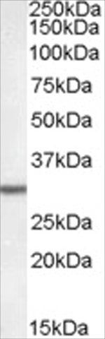 Anti-DPM1 (AB2) antibody produced in goat