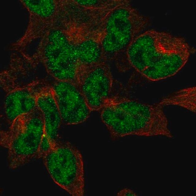 Anti-DPYSL5 antibody produced in rabbit