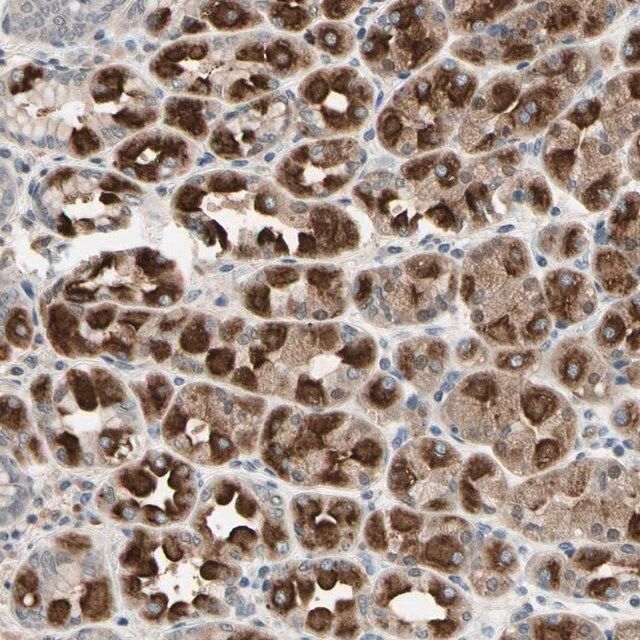 Anti-DPY19L3 antibody produced in rabbit