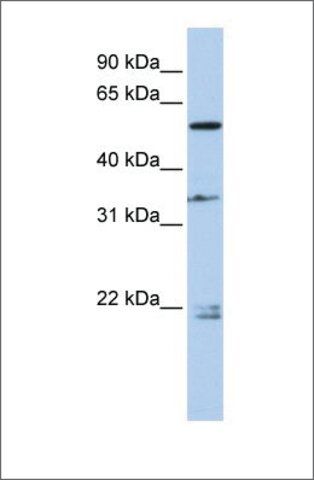 Anti-DPYSL2 antibody produced in rabbit