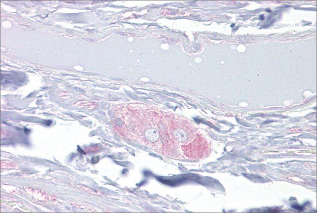 Anti-DPYSL3 antibody produced in rabbit