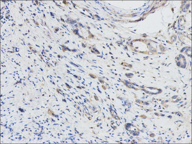 Anti-DPYD antibody produced in rabbit
