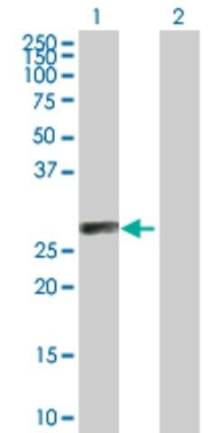 Anti-C1QTNF6, (C-terminal) antibody produced in mouse