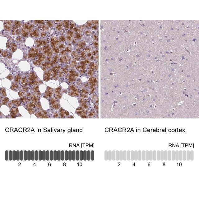 Anti-CRACR2A antibody produced in rabbit