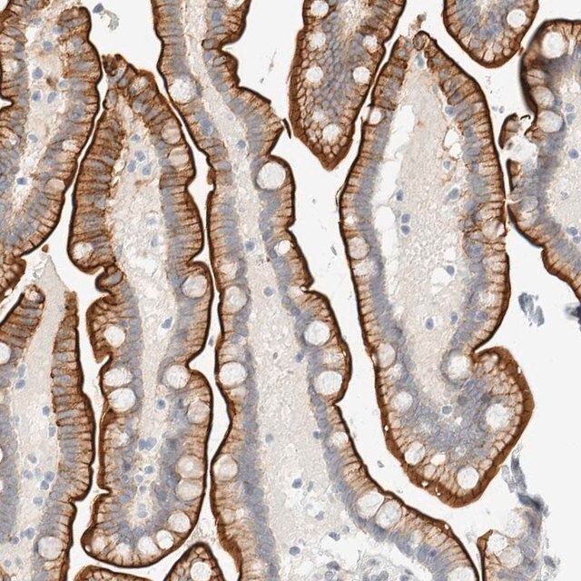 Anti-C1QTNF12 antibody produced in rabbit
