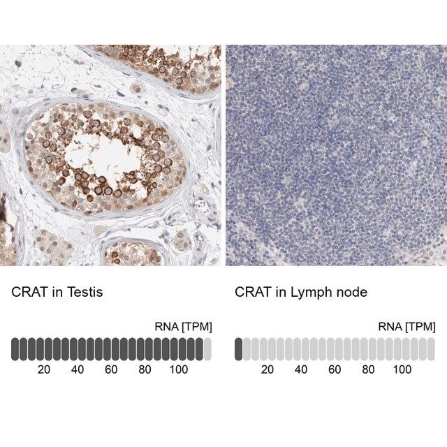 Anti-CRAT antibody produced in rabbit