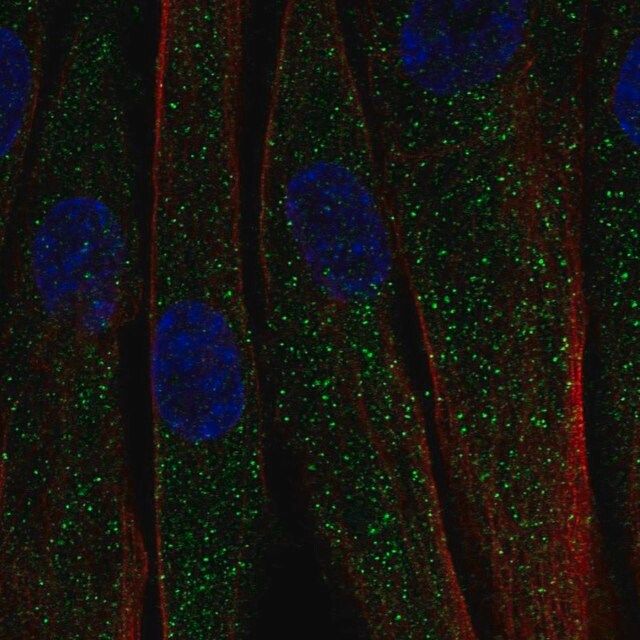 Anti-C1QTNF7 antibody produced in rabbit