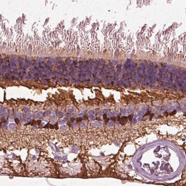 Anti-CRABP1 antibody produced in rabbit