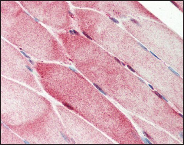 Anti-C1QTNF7 antibody produced in rabbit