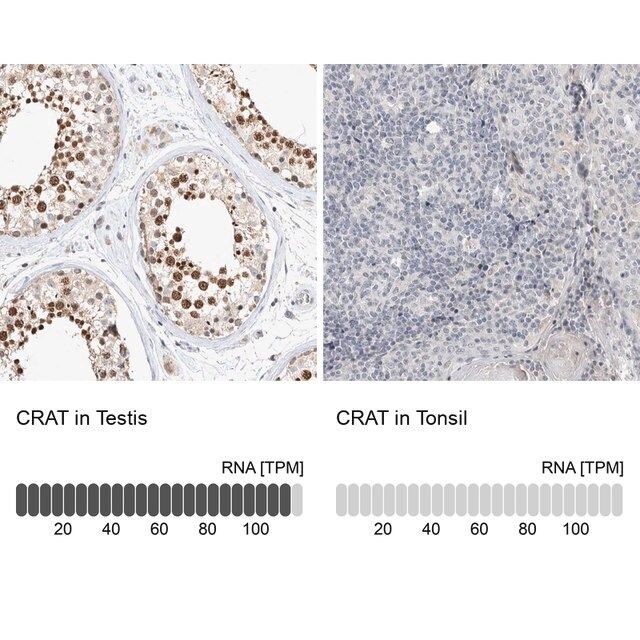 Anti-CRAT antibody produced in rabbit