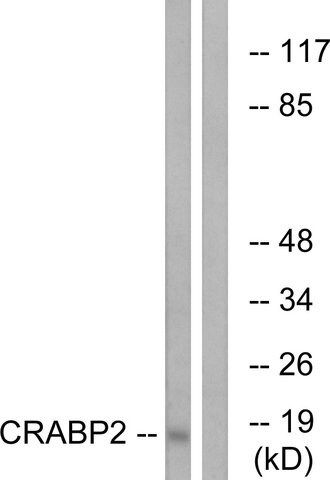 Anti-CRABP2 antibody produced in rabbit