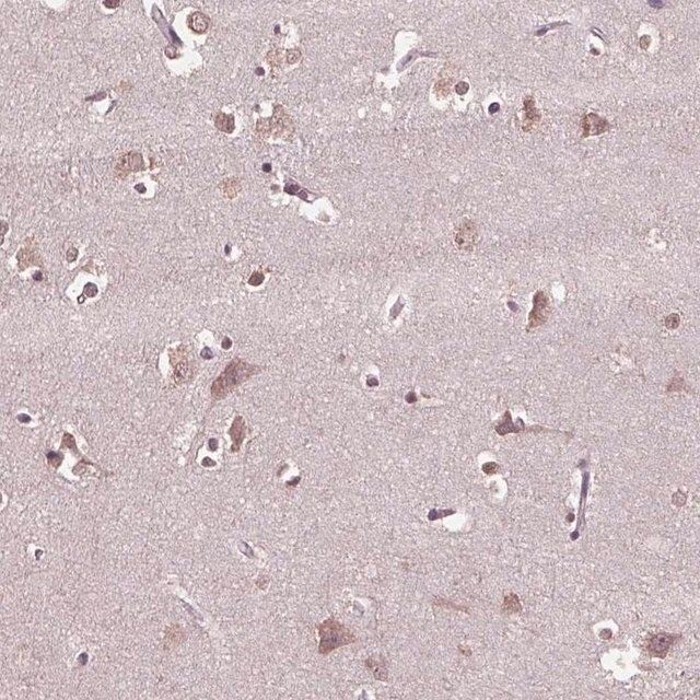 Anti-CPT1C antibody produced in rabbit