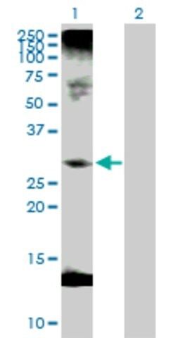 Anti-C1QTNF1 antibody produced in rabbit